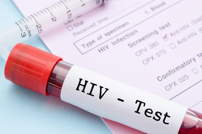 HIV Funding Crisis: Could Africa Lose Decades of Progress?